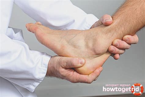 ayak bileği ekleminde deforme olan artroz tedavisi
